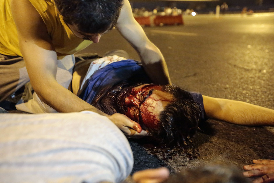 Поранені на одній з вулиць Анкари Фото: Getty Images