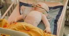 ​Від газового котла 1-річний хлопчик загорівся, як смолоскип: стан вкрай тяжкий (відео)
