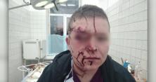 У Києві пацієнт травмпункту влаштував криваву бійню: у медика численні переломи (відео)