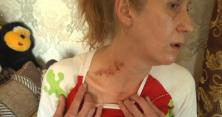 На Харківщині чоловік зґвалтував та звіряче побив екс-кохану (відео)