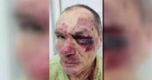 На Рівненщині пенсіонера жорстоко били та катували : нападники відомі, але не затримані (відео)
