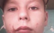 На Рівненщині безвісти зник 13-річний хлопчик